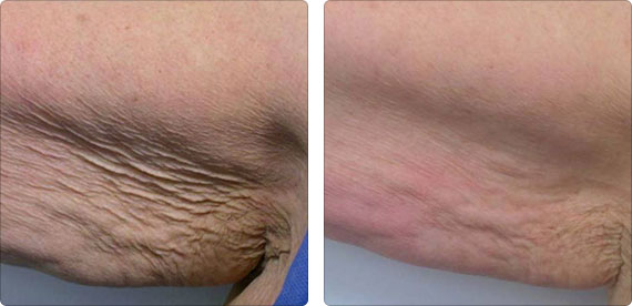 arm1.jpg