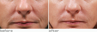 beforeafter.jpg